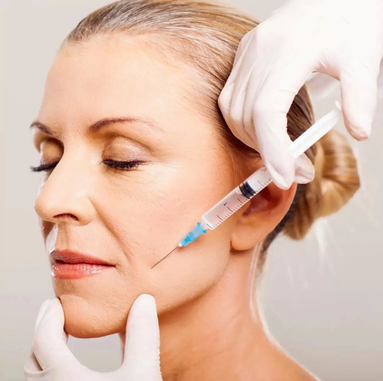 PRP-ліфтінг: Омолодження вашою власною плазмою. Як працює «еліксир молодості» з вашої крові